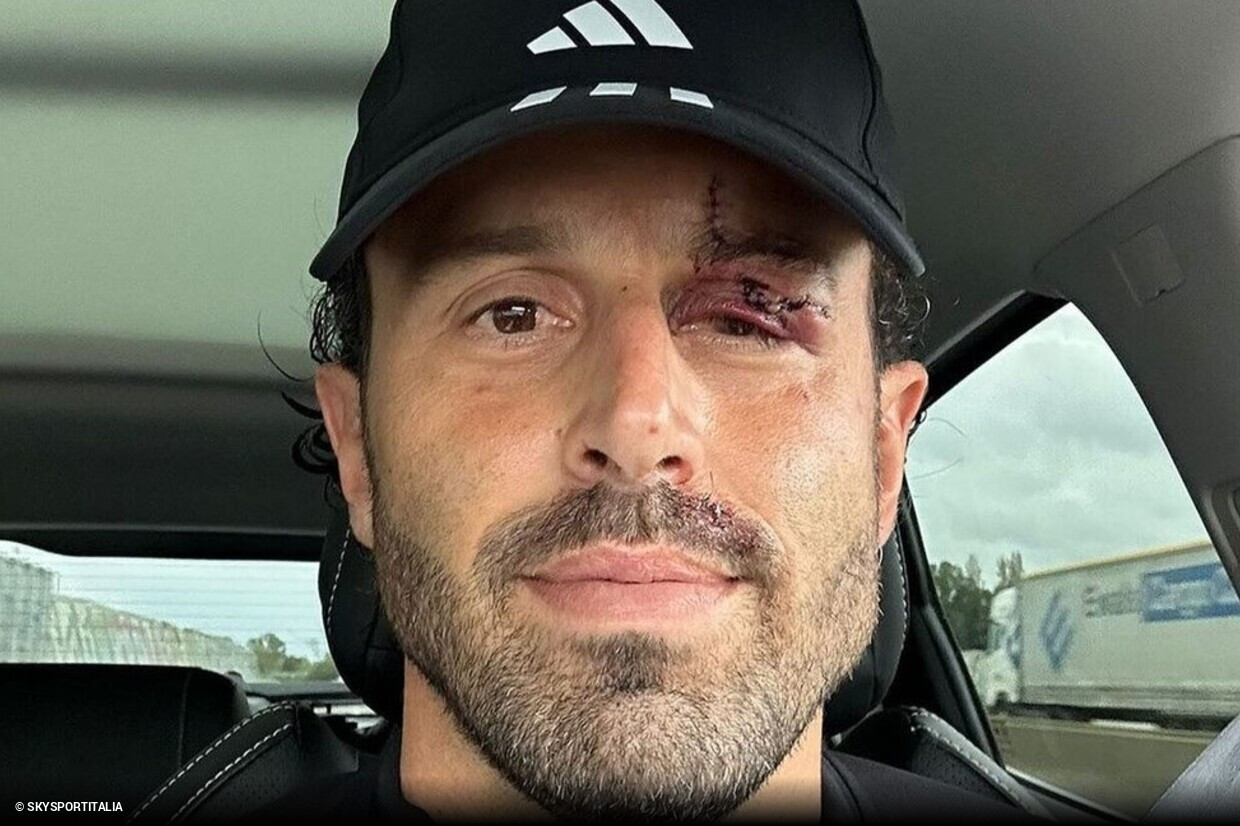 Fabio Grosso Treinador Frosinone Durante Partida Campeonato